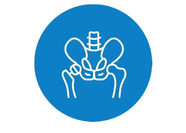 Arthroplasty